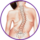 Adult Kyphosis-Types and Causes