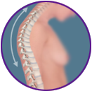 Adult Kyphosis