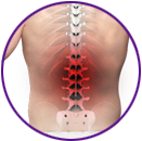 Mid-back Pain