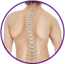 Scoliosis